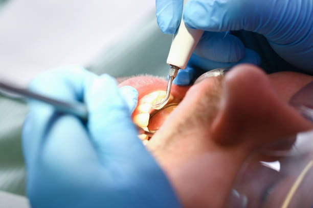 Best Tooth Pain Emergency Relief  in Lake Holiday, IN